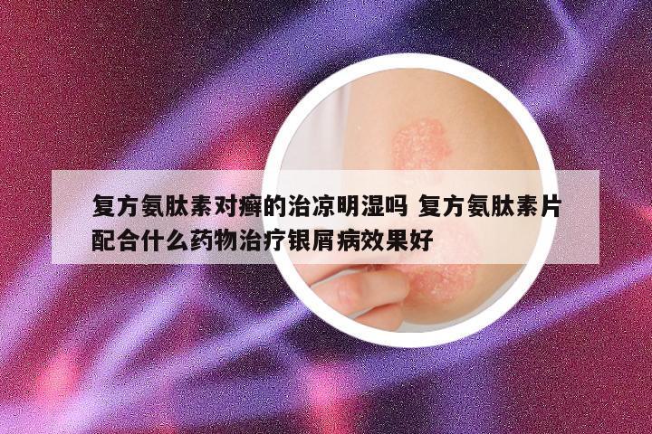 复方氨肽素对癣的治凉明湿吗 复方氨肽素片配合什么药物治疗银屑病效果好