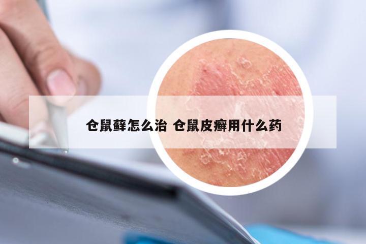 仓鼠藓怎么治 仓鼠皮癣用什么药