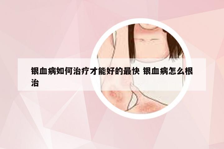 银血病如何治疗才能好的最快 银血病怎么根治