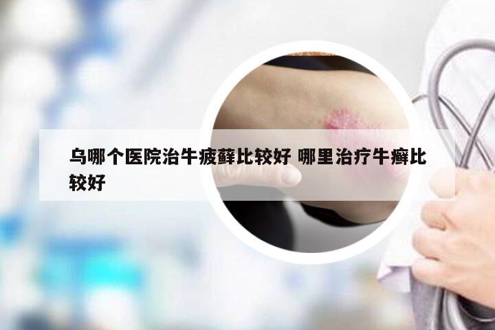 乌哪个医院治牛疲藓比较好 哪里治疗牛癣比较好