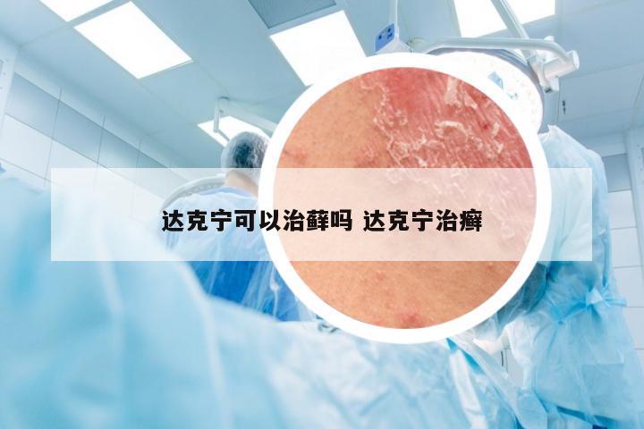 达克宁可以治藓吗 达克宁治癣