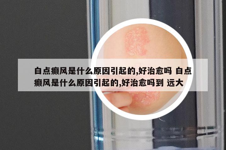 白点癫风是什么原因引起的,好治愈吗 白点癫风是什么原因引起的,好治愈吗到 远大