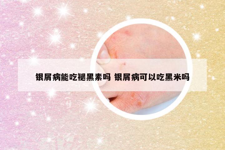 银屑病能吃褪黑素吗 银屑病可以吃黑米吗