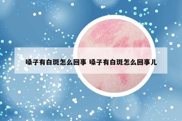 嗓子有白斑怎么回事 嗓子有白斑怎么回事儿