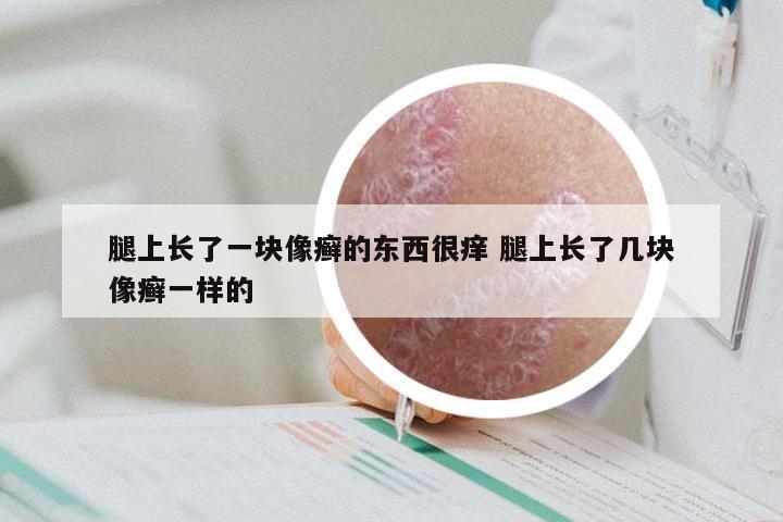 腿上长了一块像癣的东西很痒 腿上长了几块像癣一样的