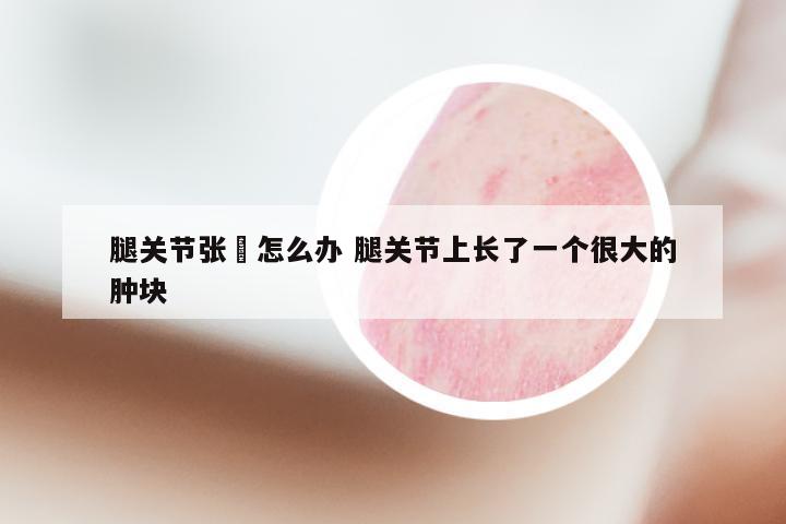 腿关节张廯怎么办 腿关节上长了一个很大的肿块