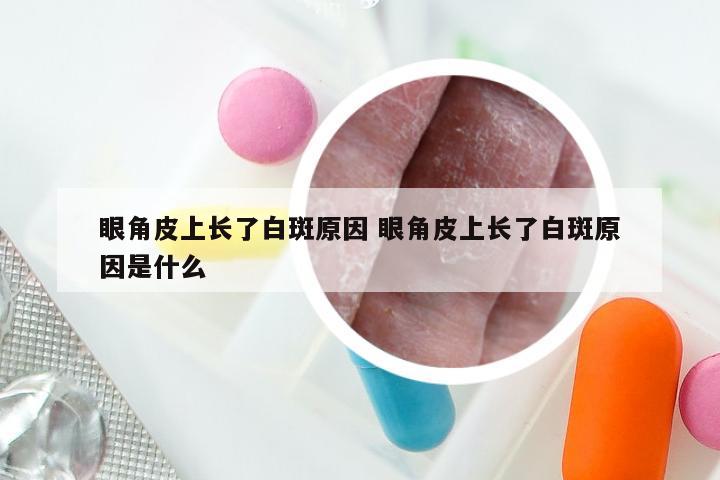 眼角皮上长了白斑原因 眼角皮上长了白斑原因是什么