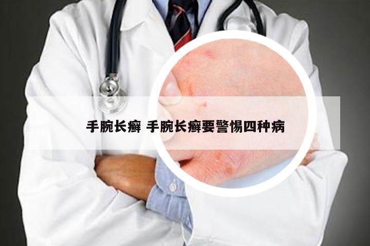 手腕长癣 手腕长癣要警惕四种病