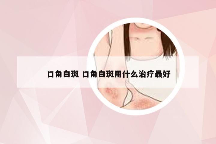 口角白斑 口角白斑用什么治疗最好