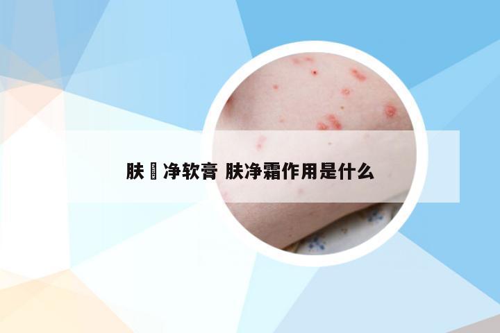 肤廯净软膏 肤净霜作用是什么