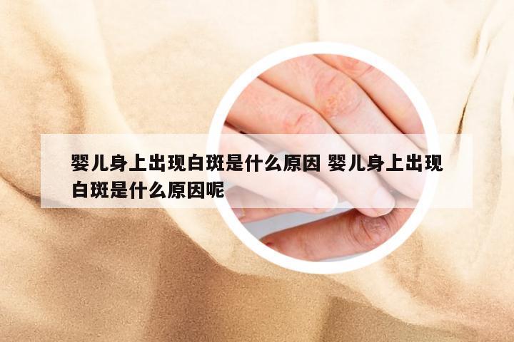 婴儿身上出现白斑是什么原因 婴儿身上出现白斑是什么原因呢