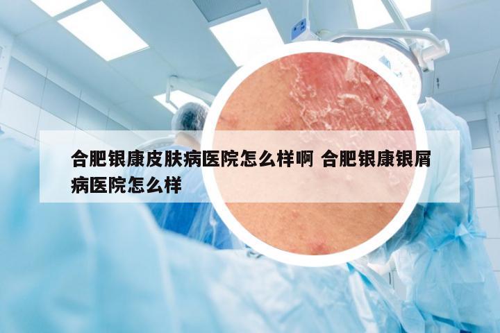 合肥银康皮肤病医院怎么样啊 合肥银康银屑病医院怎么样