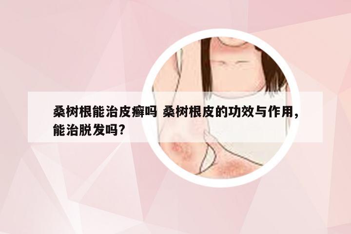 桑树根能治皮癣吗 桑树根皮的功效与作用,能治脱发吗?