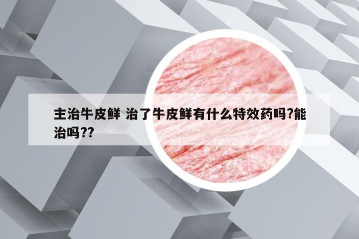 主治牛皮鲜 治了牛皮鲜有什么特效药吗?能治吗??