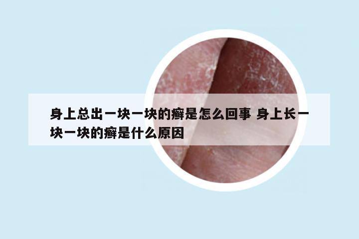 身上总出一块一块的癣是怎么回事 身上长一块一块的癣是什么原因