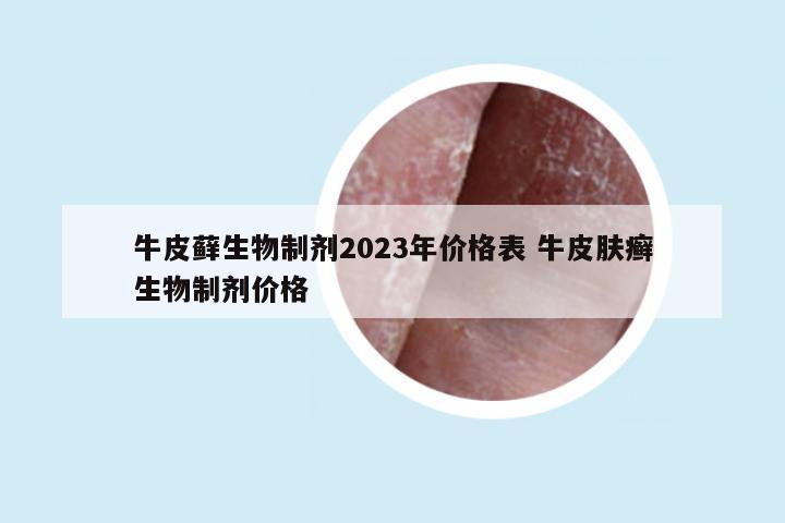 牛皮藓生物制剂2023年价格表 牛皮肤癣生物制剂价格