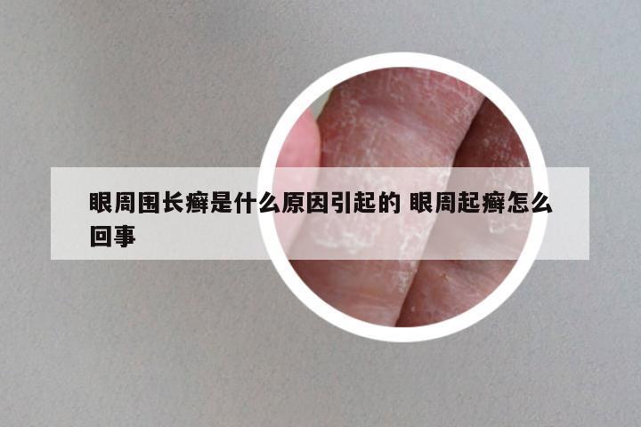 眼周围长癣是什么原因引起的 眼周起癣怎么回事