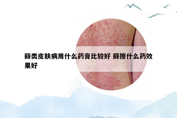 藓类皮肤病用什么药膏比较好 藓擦什么药效果好