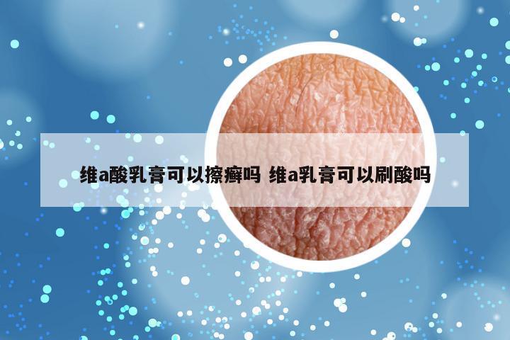 维a酸乳膏可以擦癣吗 维a乳膏可以刷酸吗