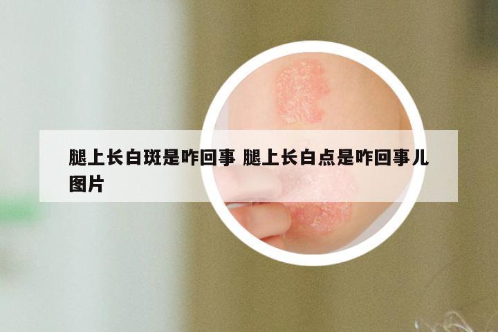 腿上长白斑是咋回事 腿上长白点是咋回事儿图片