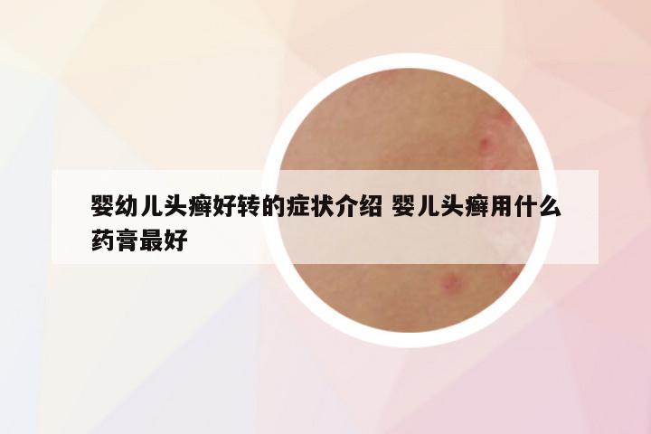 婴幼儿头癣好转的症状介绍 婴儿头癣用什么药膏最好