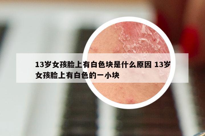 13岁女孩脸上有白色块是什么原因 13岁女孩脸上有白色的一小块