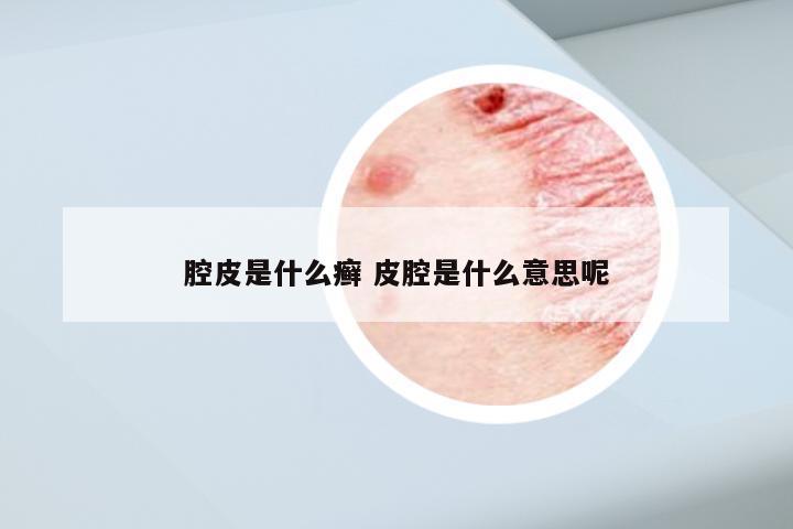 腔皮是什么癣 皮腔是什么意思呢