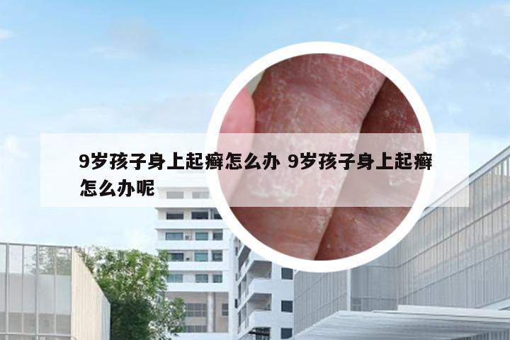 9岁孩子身上起癣怎么办 9岁孩子身上起癣怎么办呢