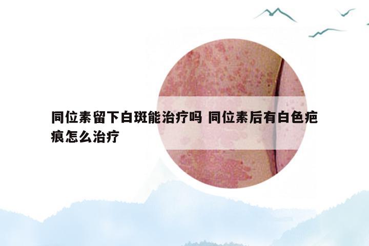 同位素留下白斑能治疗吗 同位素后有白色疤痕怎么治疗