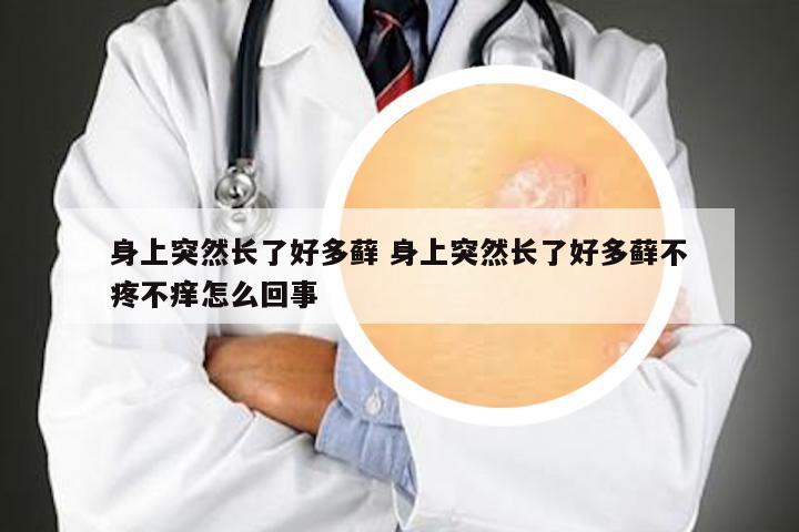 身上突然长了好多藓 身上突然长了好多藓不疼不痒怎么回事