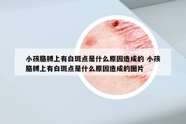 小孩胳膊上有白斑点是什么原因造成的 小孩胳膊上有白斑点是什么原因造成的图片