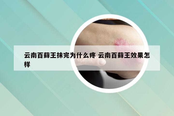 云南百藓王抹完为什么疼 云南百藓王效果怎样