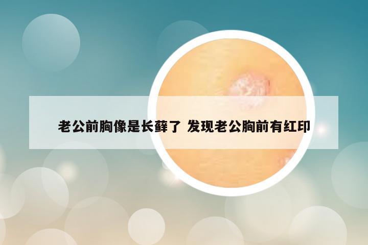 老公前胸像是长藓了 发现老公胸前有红印