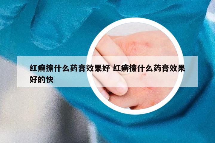 红癣擦什么药膏效果好 红癣擦什么药膏效果好的快