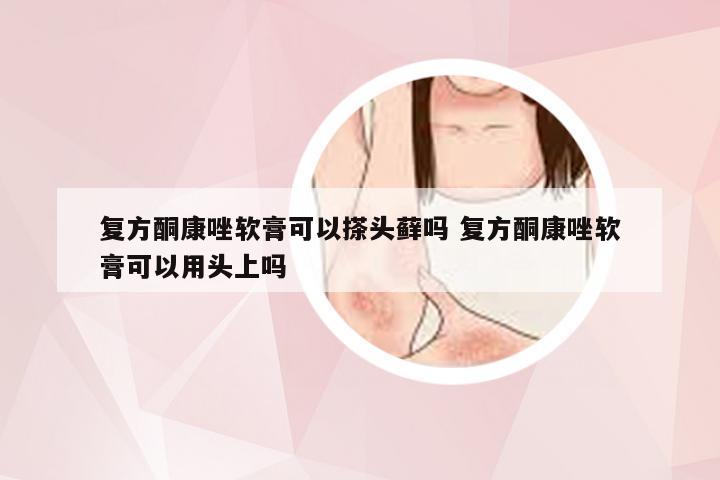 复方酮康唑软膏可以搽头藓吗 复方酮康唑软膏可以用头上吗