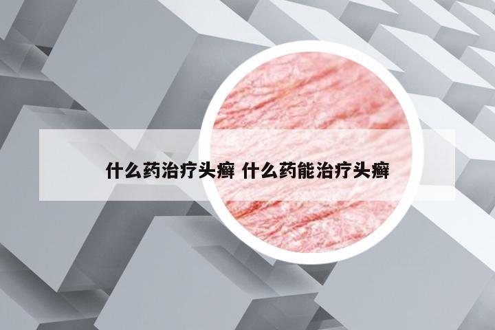 什么药治疗头癣 什么药能治疗头癣