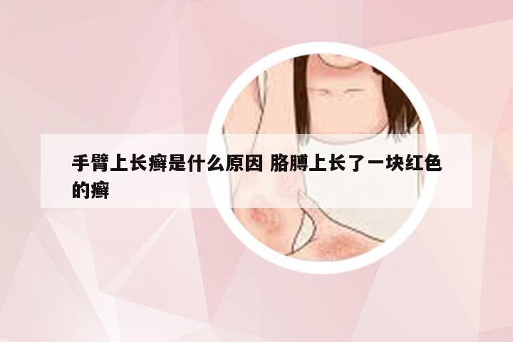 手臂上长癣是什么原因 胳膊上长了一块红色的癣