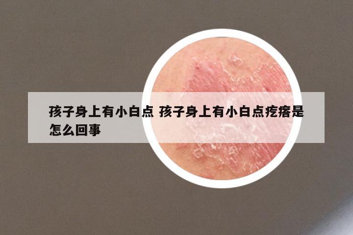 孩子身上有小白点 孩子身上有小白点疙瘩是怎么回事