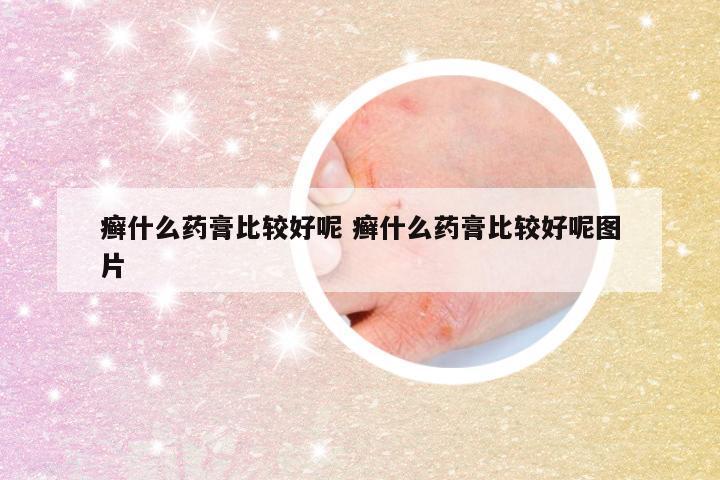 癣什么药膏比较好呢 癣什么药膏比较好呢图片