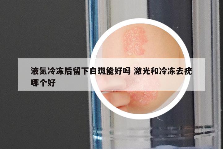 液氮冷冻后留下白斑能好吗 激光和冷冻去疣哪个好