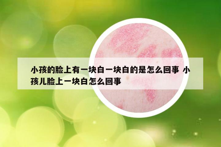 小孩的脸上有一块白一块白的是怎么回事 小孩儿脸上一块白怎么回事