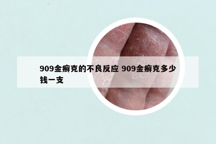 909金癣克的不良反应 909金癣克多少钱一支