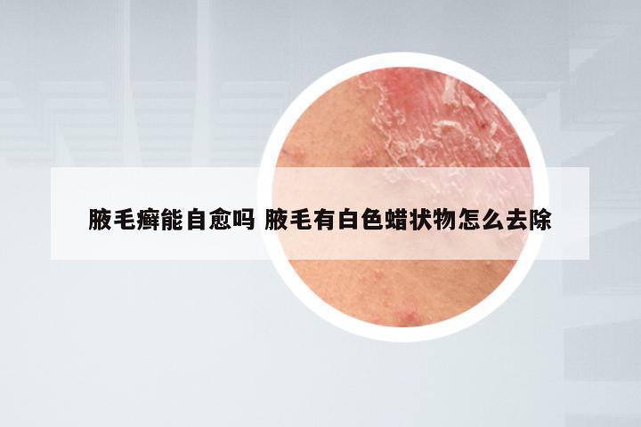 腋毛癣能自愈吗 腋毛有白色蜡状物怎么去除