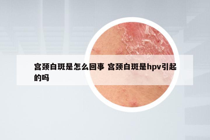 宫颈白斑是怎么回事 宫颈白斑是hpv引起的吗