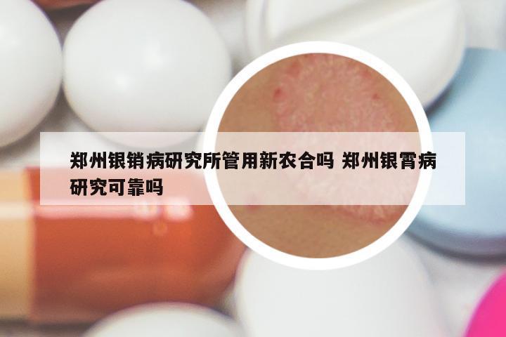 郑州银销病研究所管用新农合吗 郑州银霄病研究可靠吗