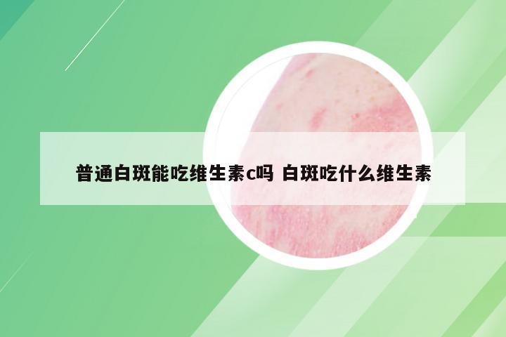 普通白斑能吃维生素c吗 白斑吃什么维生素