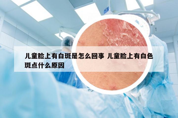 儿童脸上有白斑是怎么回事 儿童脸上有白色斑点什么原因