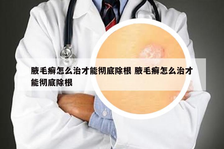 腋毛癣怎么治才能彻底除根 腋毛癣怎么治才能彻底除根