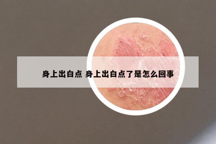 身上出白点 身上出白点了是怎么回事