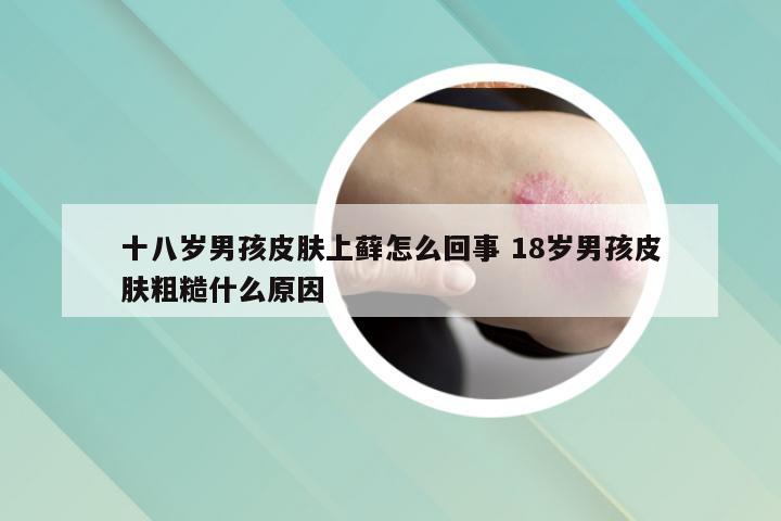 十八岁男孩皮肤上藓怎么回事 18岁男孩皮肤粗糙什么原因